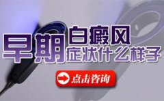 长沙白癜风医生王桂英